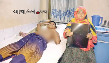 ফুসফুসে গুলি নিয়ে কাতরাচ্ছে মাদ্রাসার শিক্ষার্থী রাশেদ মিয়া