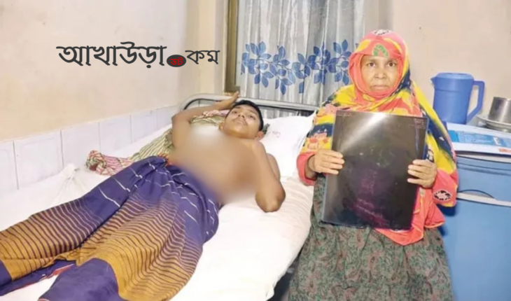 ফুসফুসে গুলি নিয়ে কাতরাচ্ছে মাদ্রাসার শিক্ষার্থী রাশেদ মিয়া